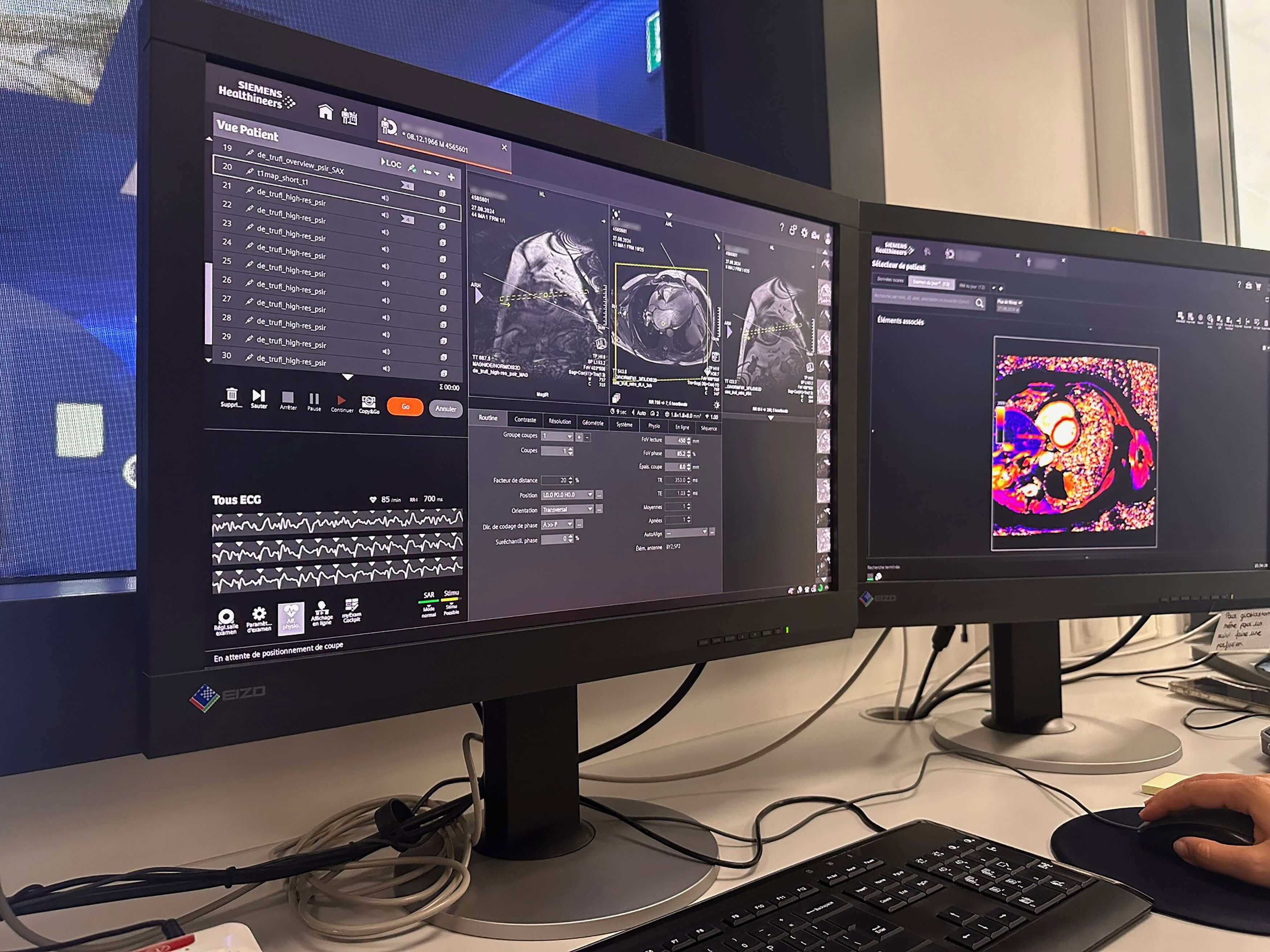 Cardiologie