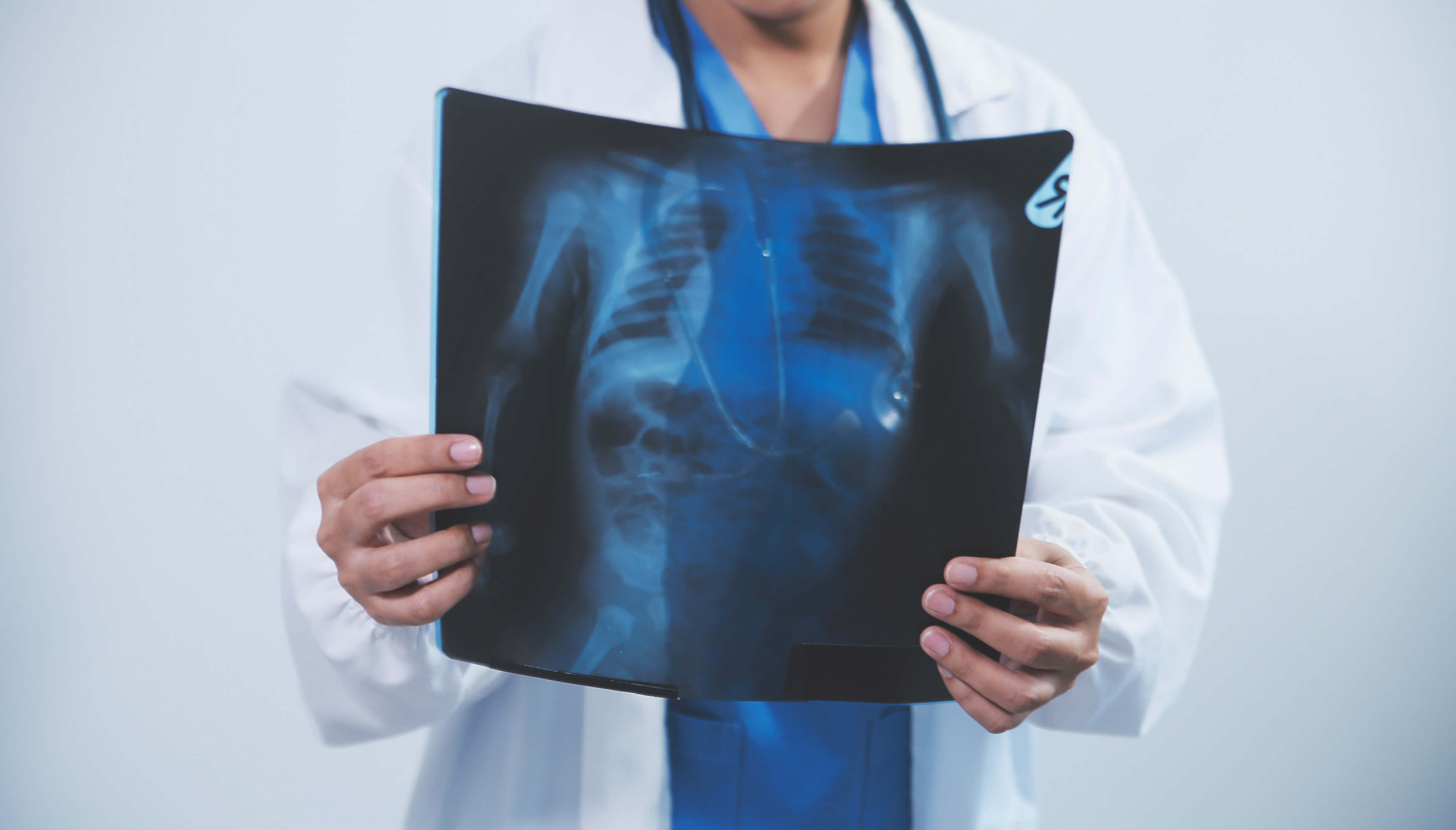 Chirurgie thoracique